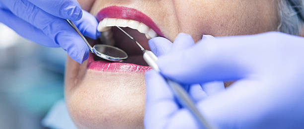 Best Broken or Cracked Tooth Emergency Dentist in Girard, OH