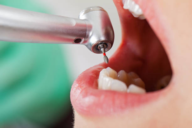 Best Emergency Dental Services for Seniors in Girard, OH